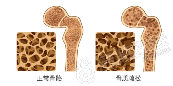如何给牙齿补钙(牙齿补钙吃什么钙片好)-硒宝网