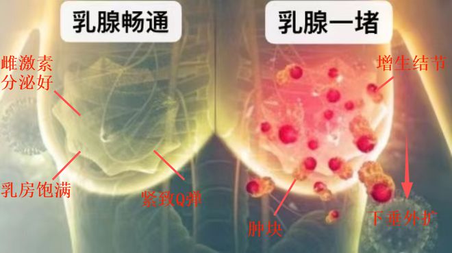 乳腺癌 硒维康(硒对乳腺癌的作用)-硒宝网