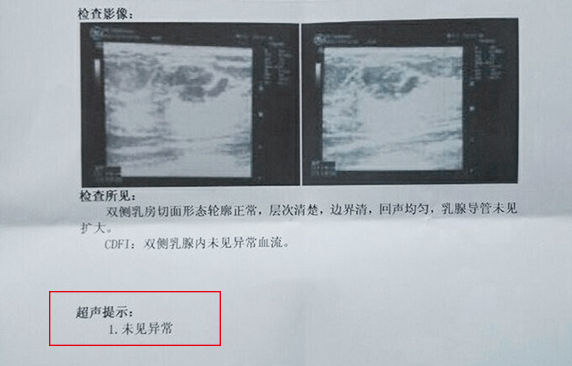 乳腺癌 硒维康(硒对乳腺癌的作用)-硒宝网