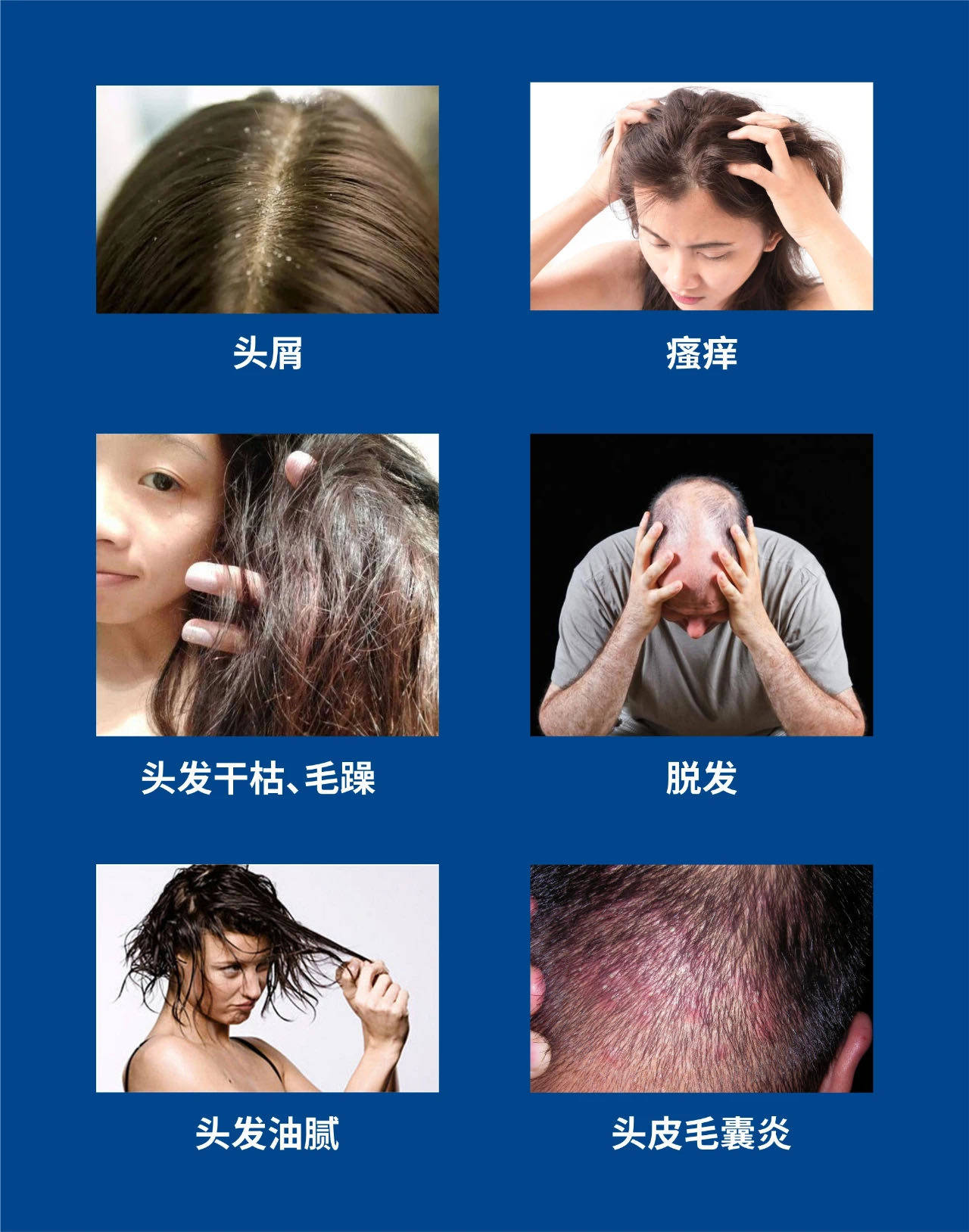 化验微量元素需要空腹吗(化验微量元素用空腹不)-硒宝网