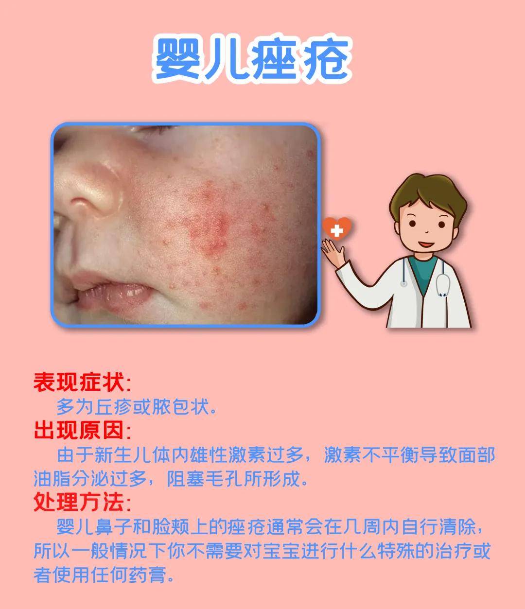 补硒治皮脂囊肿（皮脂囊肿外用药）-硒宝网