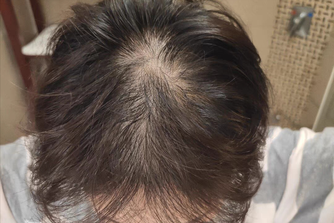 男人怎么样补硒（男性补硒的好处）-硒宝网