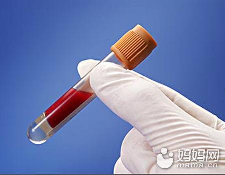 抽血查微量元素需要空腹吗(微量元素检查空腹抽血吗)-硒宝网