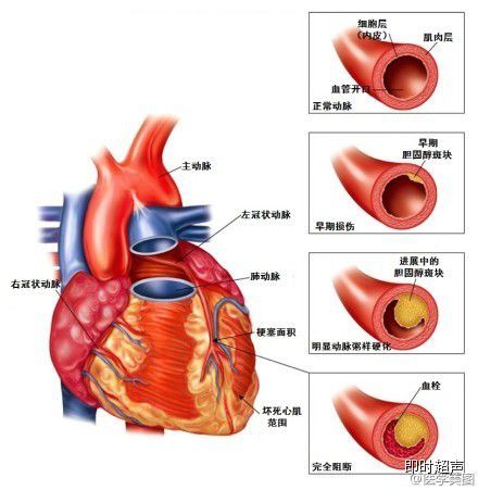 心脏病能补硒吗（补硒对心脏病人有哪些好处）-硒宝网