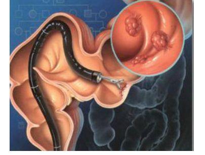 麦芽硒补硒速度（硒补麦芽速度多少合适）-硒宝网