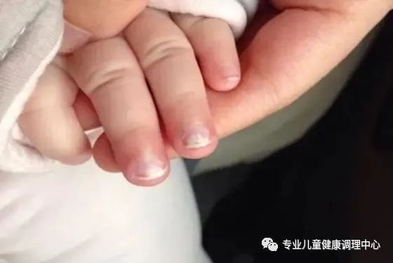 吃什么东西补锌(补锌爱吃饭)-硒宝网