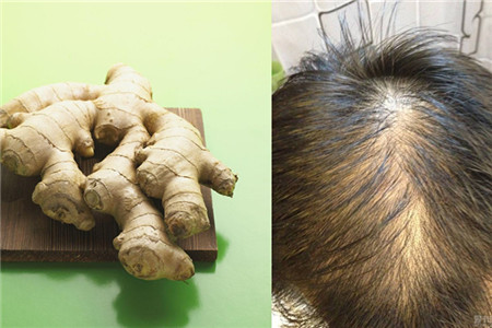 缺少什么微量元素会掉头发(缺少微量掉头发元素会怎么样)-硒宝网
