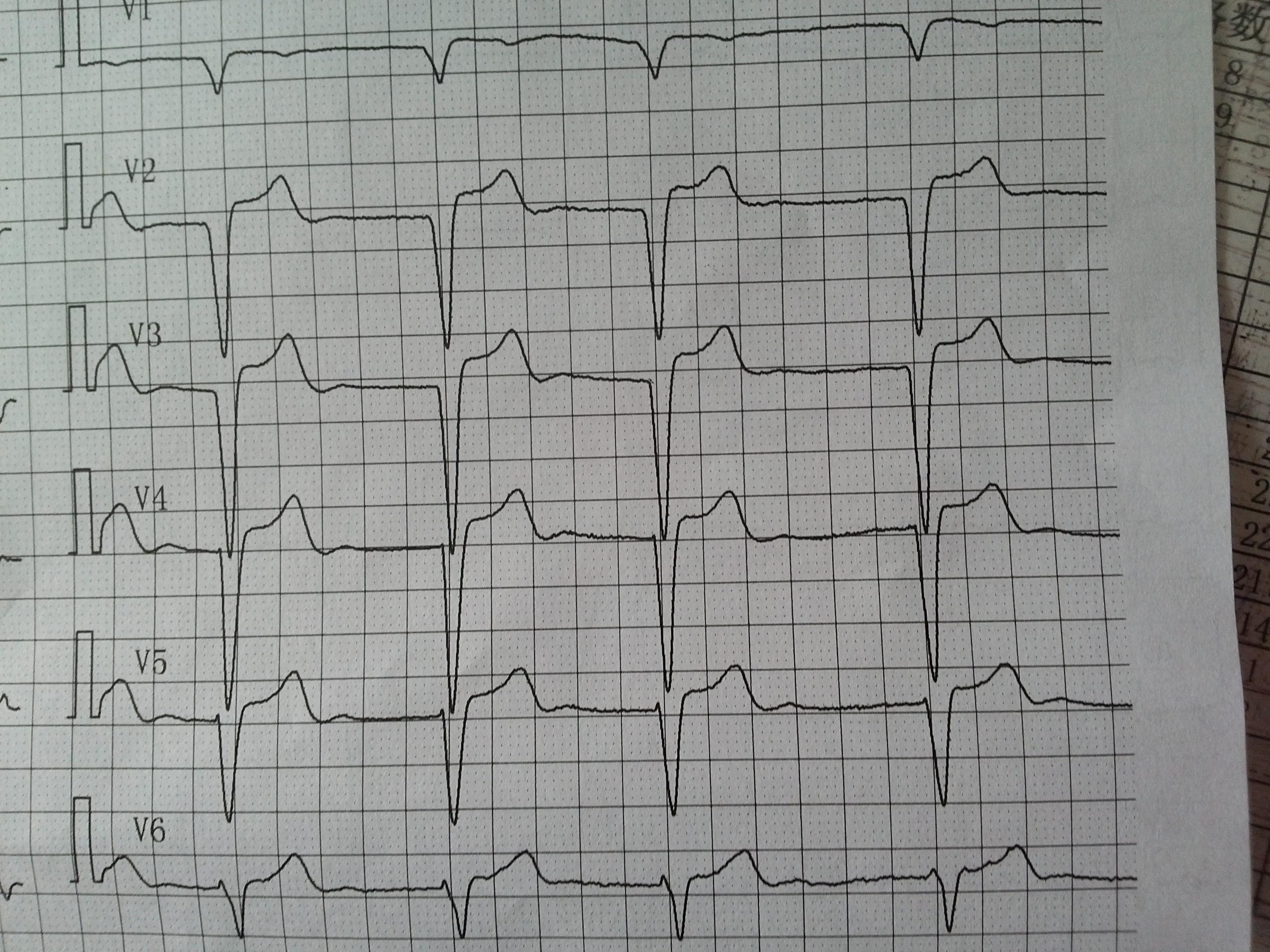 月经期间可以吃补铁的药吗(补铁药月经期间需要停用吗)-硒宝网