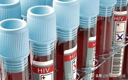 HIV患者补硒（艾滋病人补硒）-硒宝网