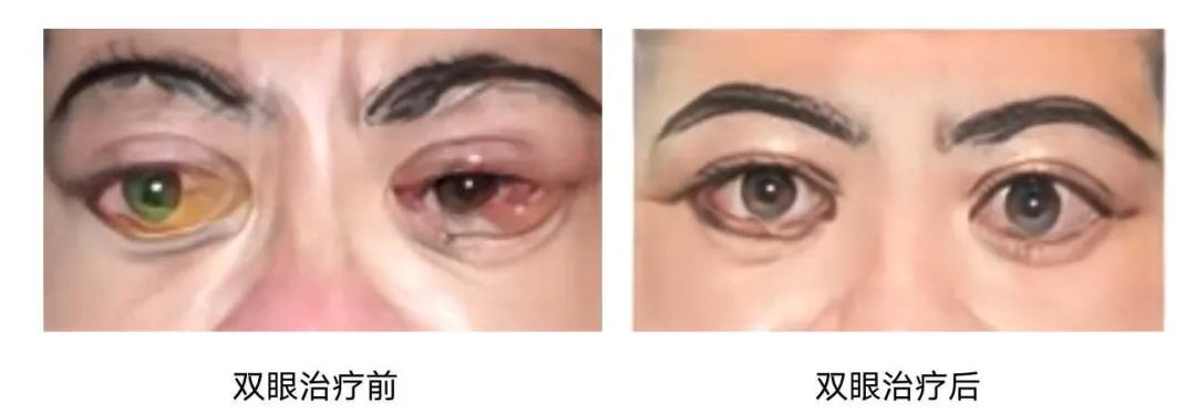 TAO补硒治疗（单独补硒的药）-硒宝网