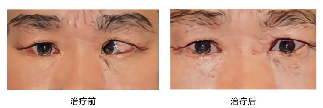 TAO补硒治疗（单独补硒的药）-硒宝网