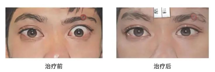 TAO补硒治疗（单独补硒的药）-硒宝网