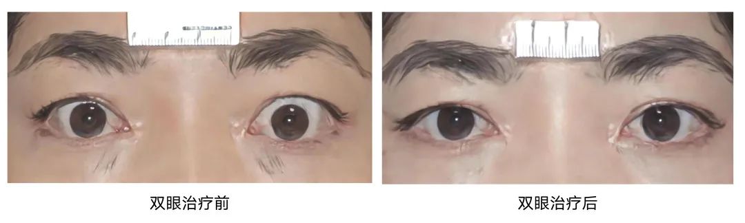 TAO补硒治疗（单独补硒的药）-硒宝网