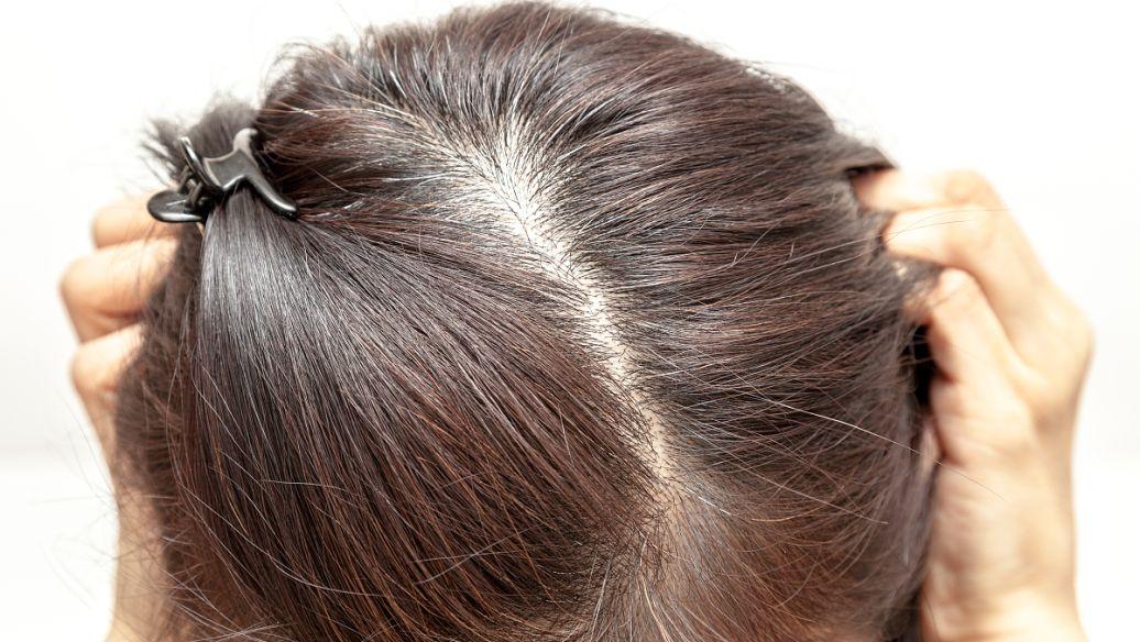 补铁可以防止掉头发吗(掉头发防止补铁可以长头发吗)-硒宝网