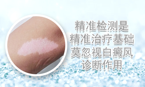 白癜风如何补硒（怎样科学补硒）-硒宝网