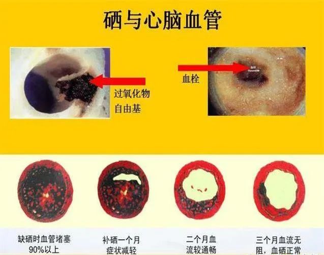 乙肝 补硒 量（乙肝补硒自愈）-硒宝网