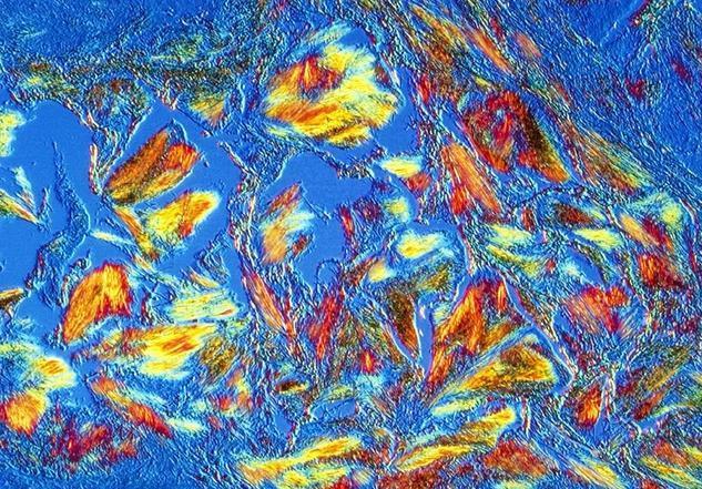 尿酸高能吃钙片补钙吗(补钙尿酸吃钙片高能喝牛奶吗)-硒宝网