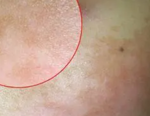 酵素可以补硒吗（酵素补硒可以长期吃吗）-硒宝网