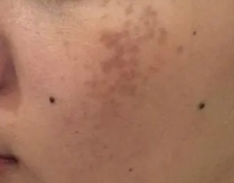 酵素可以补硒吗（酵素补硒可以长期吃吗）-硒宝网