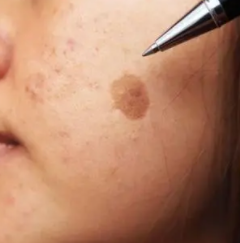 酵素可以补硒吗（酵素补硒可以长期吃吗）-硒宝网