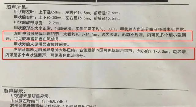 补硒甲状腺全切(甲状腺切除后补硒行吗)-硒宝网