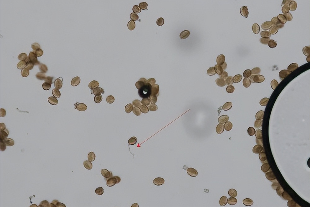 硒元素补多白带(补充硒元素)-硒宝网