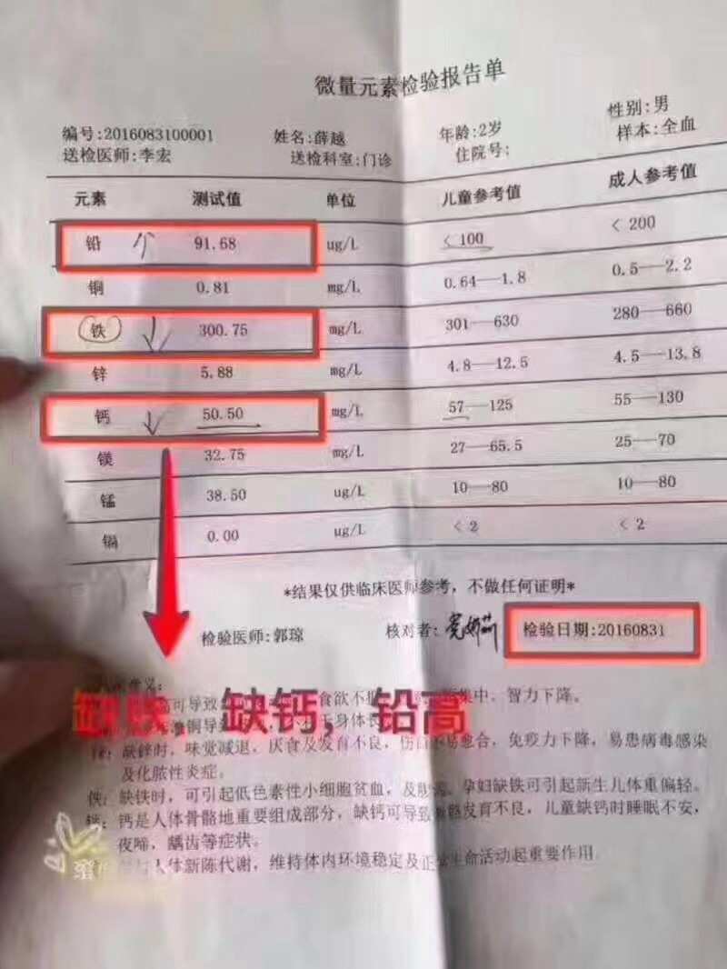 孕妇微量元素检查有必要吗（孕妇需要查微量元素需要空腹吗）-硒宝网