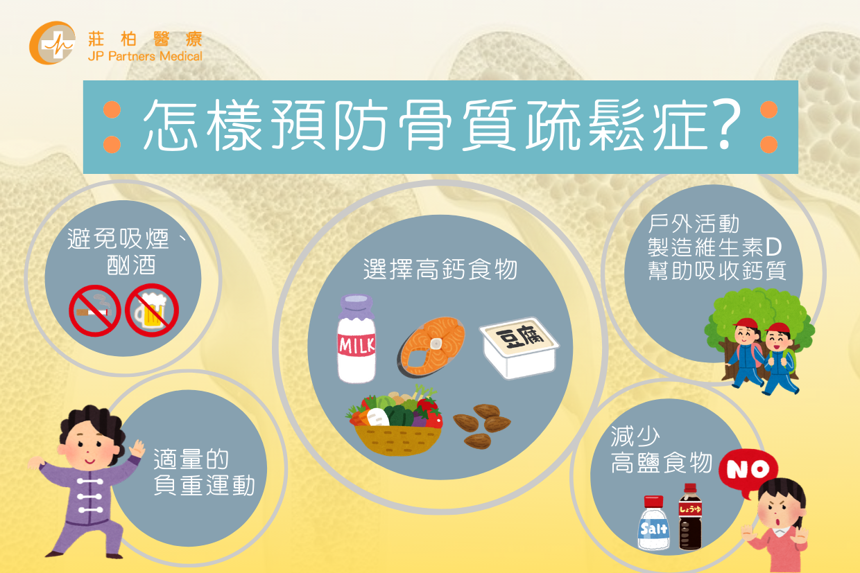 运动需要补钙吗（补钙需要运动吗）-硒宝网