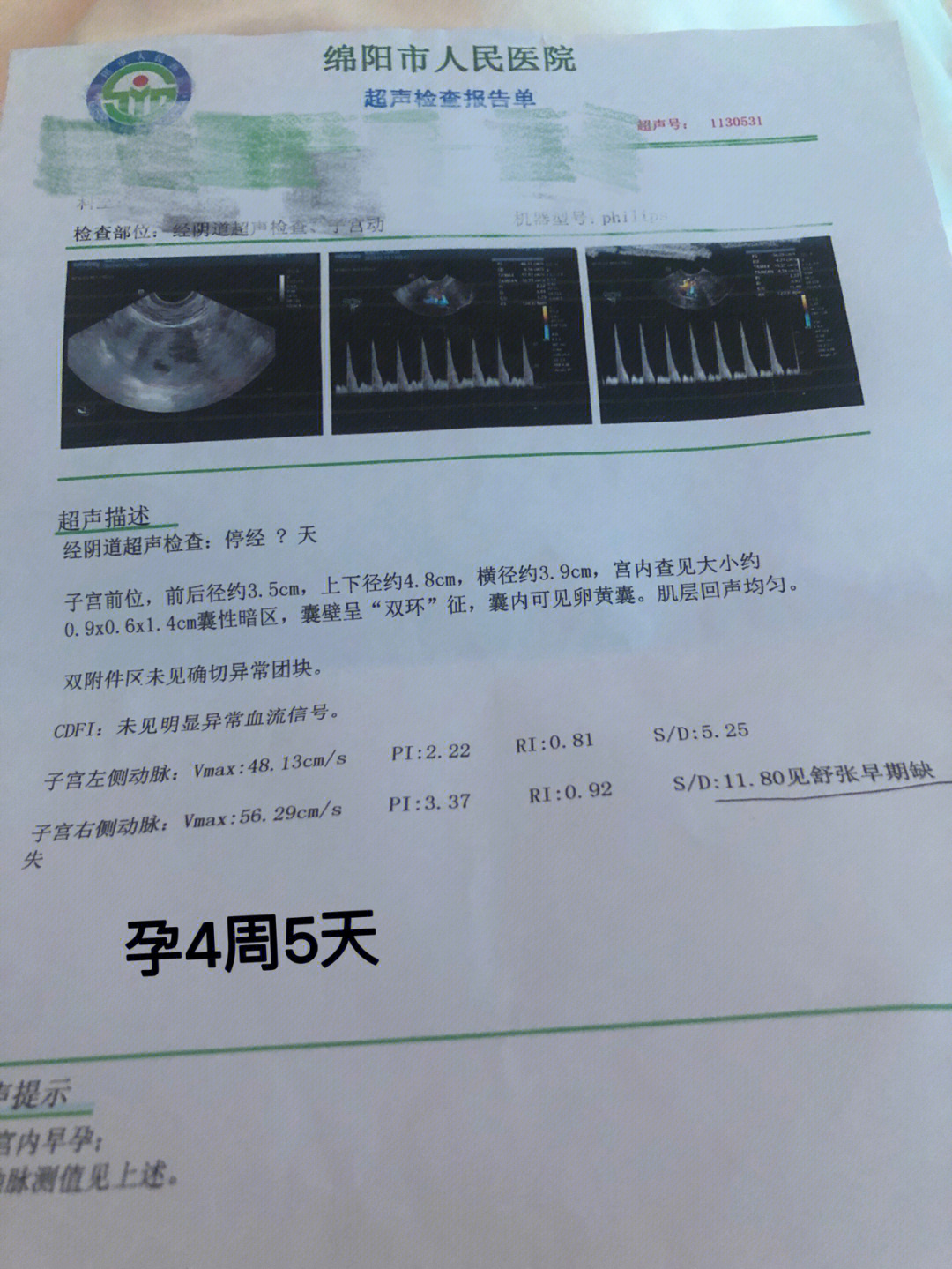 孕晚期怎么补硒（孕妇补硒吃什么药）-硒宝网