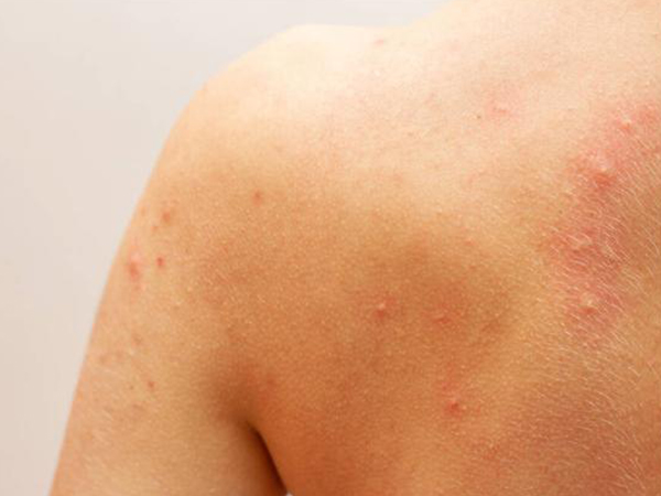 婴儿补钙辅食食谱大全（宝宝辅食补钙的食物有哪些）-硒宝网