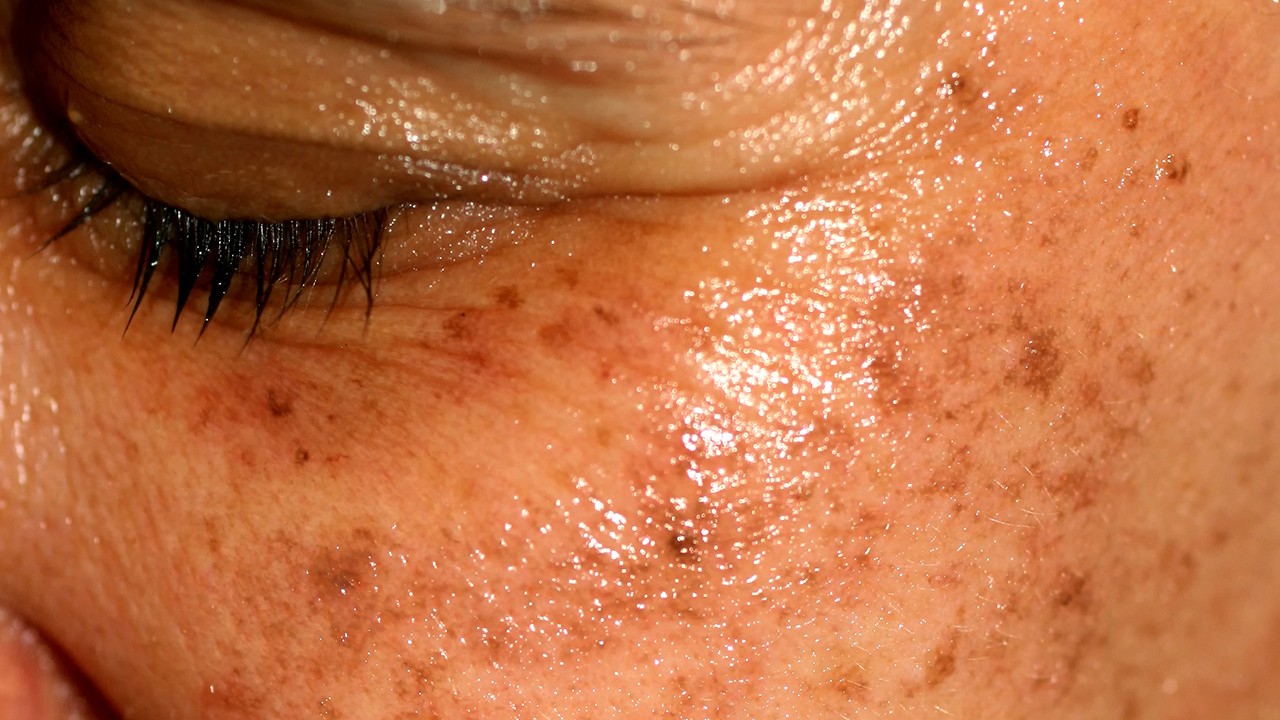 核桃可以补硒吗（核桃补硒可以天天吃吗）-硒宝网