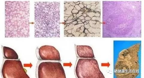 补硒不得眼病吗（硒与眼?。?硒宝网