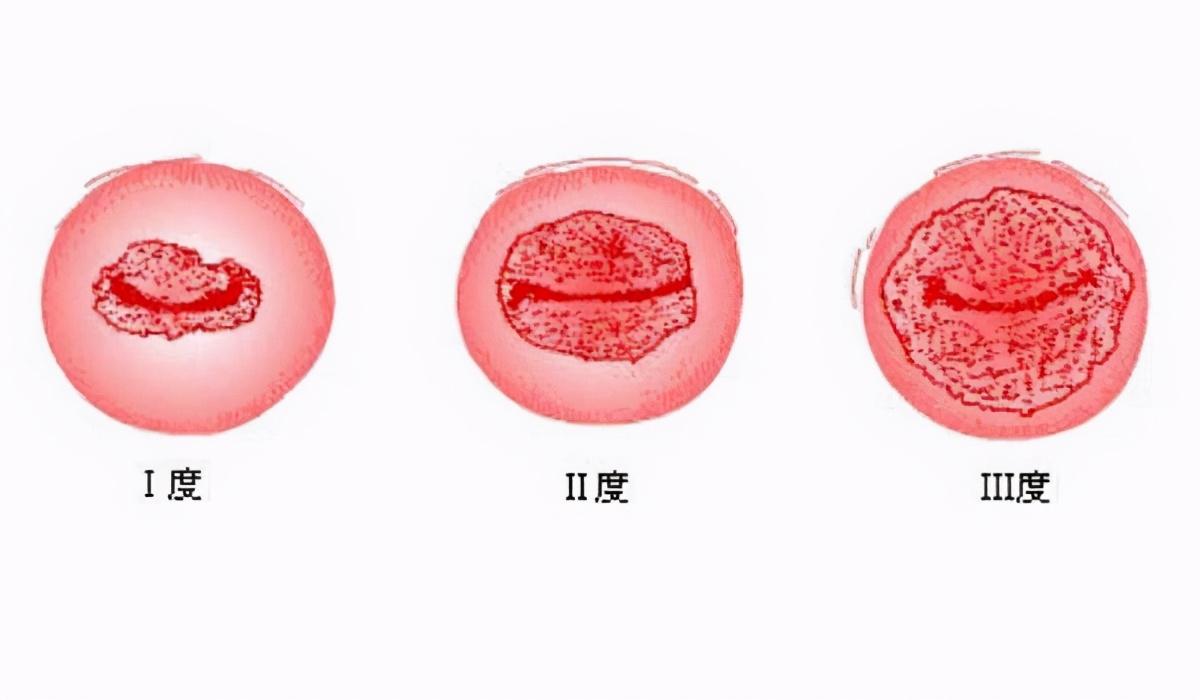 补硒对宫颈好吗(补硒对宫颈炎有好处吗)-硒宝网