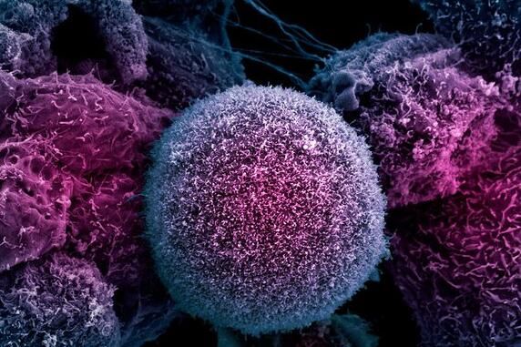 补硒和胆道炎症（硒对胆囊炎的作用）-硒宝网