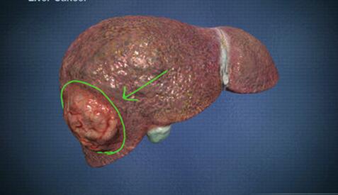 有补硒护肝片吗(养肝护肝补硒买啥药)-硒宝网