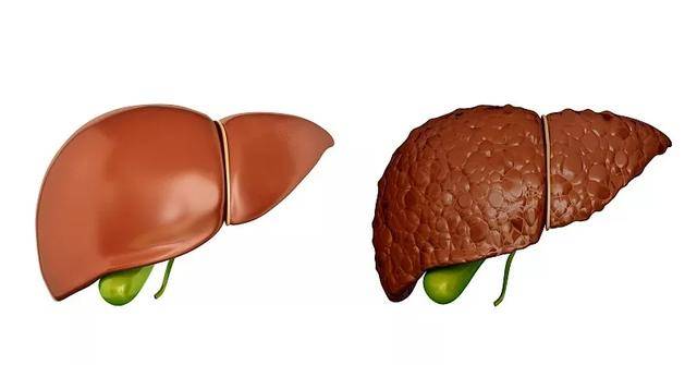 有补硒护肝片吗(补片护肝硒有副作用吗)-硒宝网