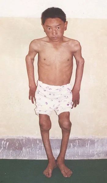 土地缺硒怎么补（土壤缺硒）-硒宝网