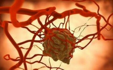 胃癌后怎么补硒(硒对胃癌)-硒宝网