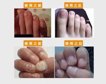 澳洲补硒的保健（澳洲补硒元素产品）-硒宝网