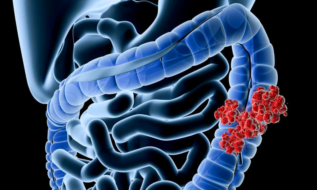 如何科学补石硒（科学补硒势在必行）-硒宝网