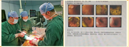 胃癌后怎么补硒（胃癌补硒有好处吗）-硒宝网