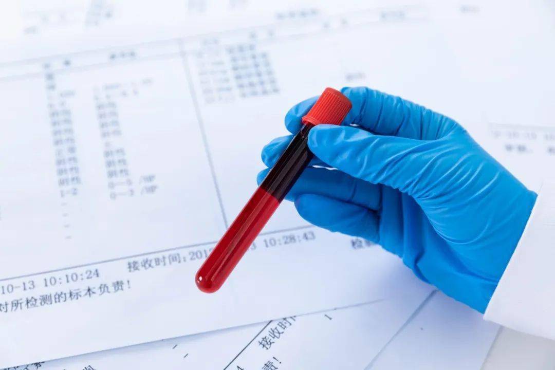 化验微量元素用空腹吗(空腹测微量元素准吗)-硒宝网