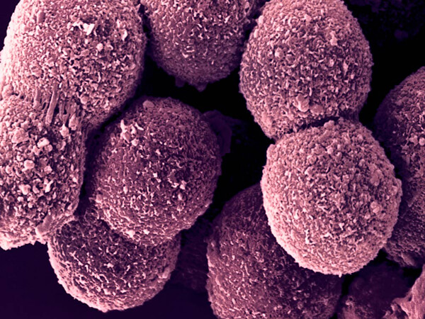 补硒有哪些改善(补硒能解决身体哪些问题)-硒宝网