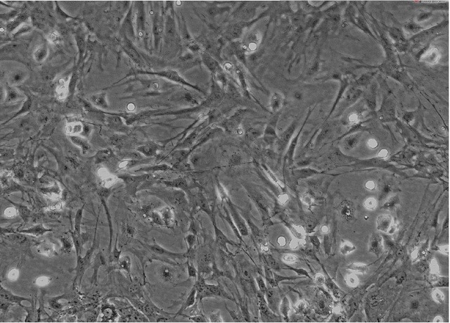 补硒有哪些改善(补硒能解决身体哪些问题)-硒宝网