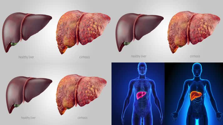 肝炎人怎样补硒(肝病患者补硒)-硒宝网