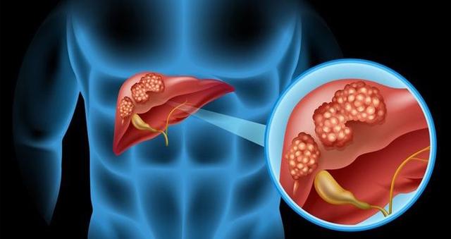 肝炎人怎样补硒(肝病患者补硒)-硒宝网