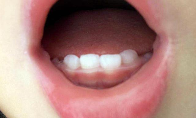 孩子需要补钙吗(补钙孩子需要补多久)-硒宝网