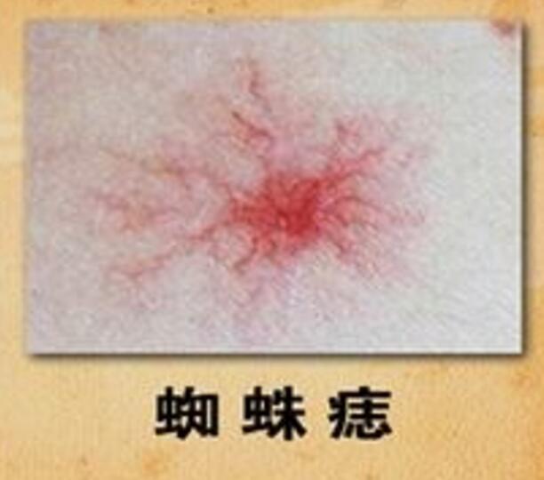 补硒使经期提前(月经期补硒可以吃吗)-硒宝网