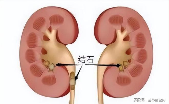 喝豆浆可以补钙吗(豆浆喝补钙可以一起吃吗)-硒宝网