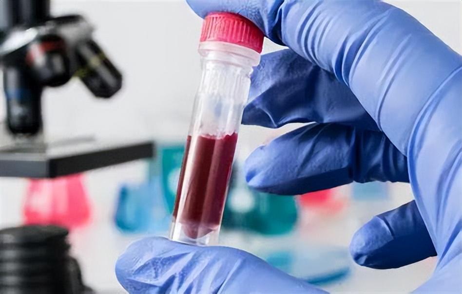 病毒肝补什么硒(补硒对肝病患者有好处吗)-硒宝网